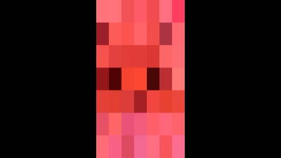 You Will Pay My Collagen Solarium Card And Collagen Cosmetics Loser!