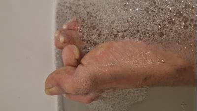 Long Toenails