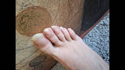Long Toenails