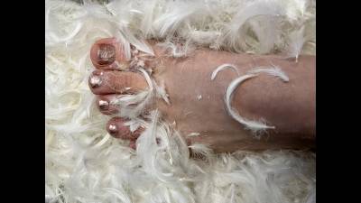 Foot Angle