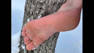 Barking Up The Right Tree