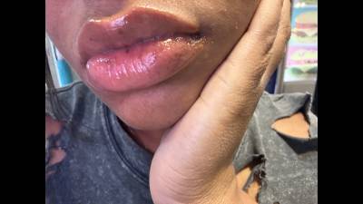 Juicy Plump Lips