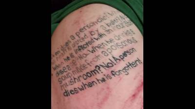 Boot Pressed Onto Client Whos Back Is Bruised