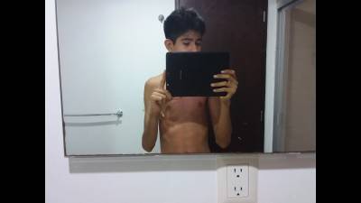 Abdomen