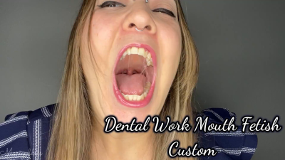 Dental Work Mouth Fetish Custom