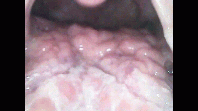 Grape Swallowing