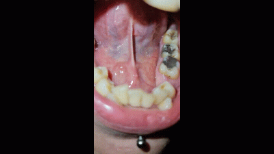 Mouth Tour