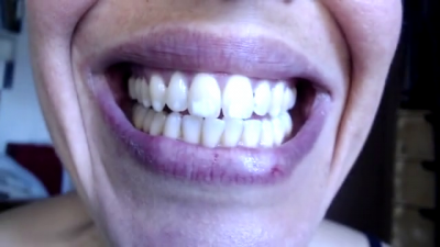 Flossing My Teeth And Mouth Tour