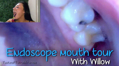 Endoscope Mouth Tour Willow Lansky