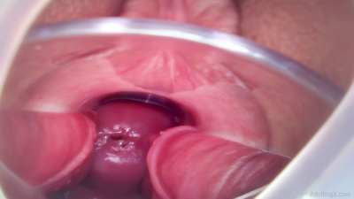 4 Orgasms With Speculum Cervix View
