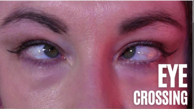 Eye Crossing And Tricks