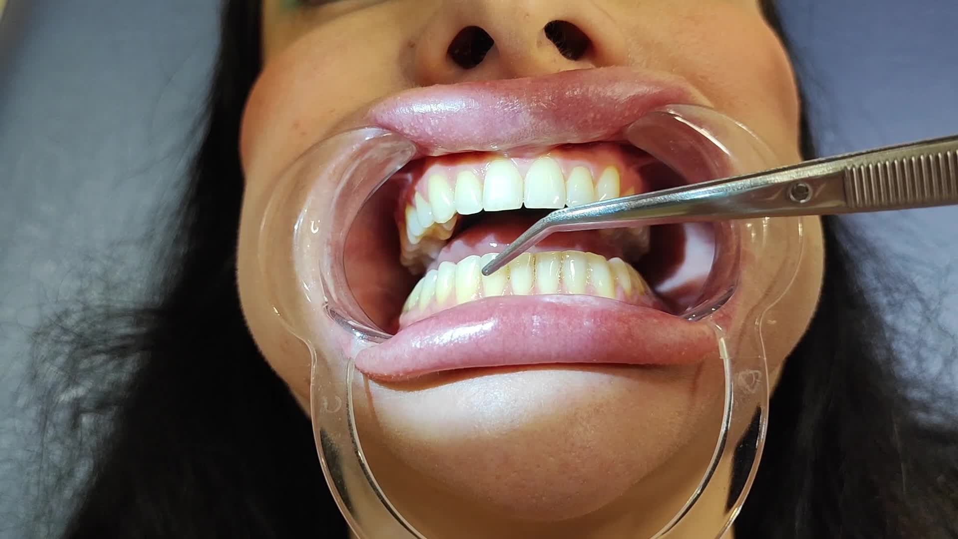 dentist fetish 