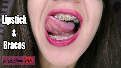 Lipstick And Braces Mouth Tour With Kisses And Saliva Upclose Brackets