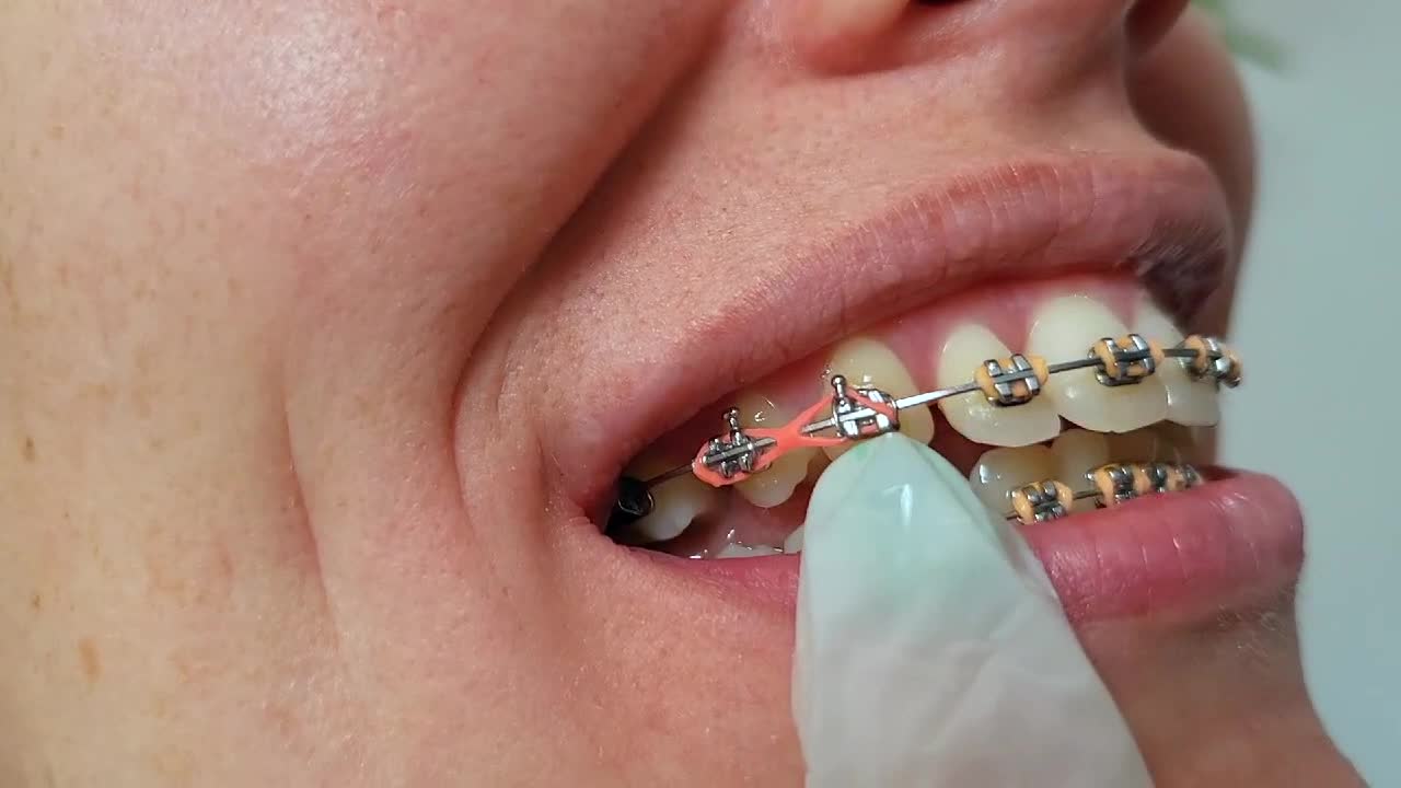 Teeth Fetish - Porn Video Clips For Sale at iWantClips - Page 24