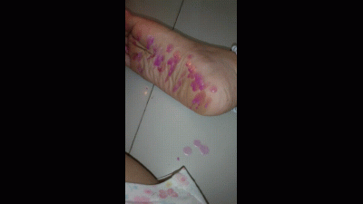Feet
