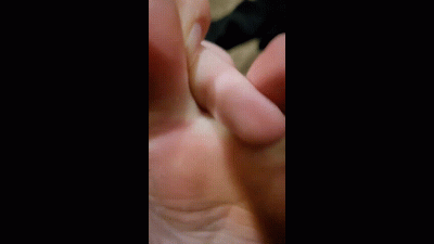 Dirty Feet Skin Peel