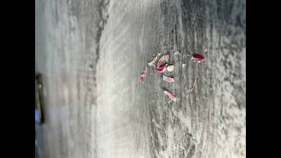 These Little Piggies Need A Trim!