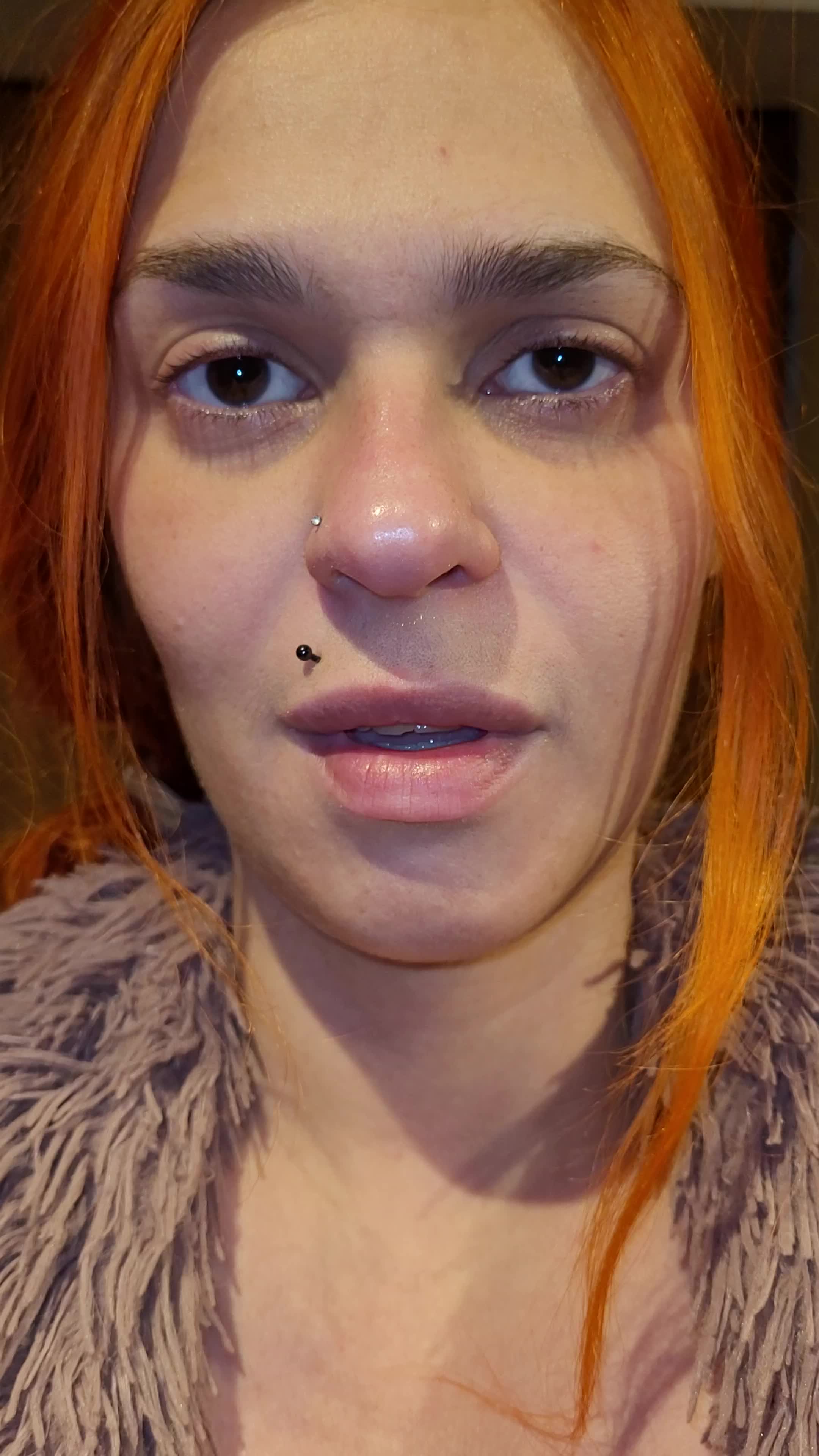 My Teeth Are Rotting Even More! Lost Tooth Progress(Infected And Black)