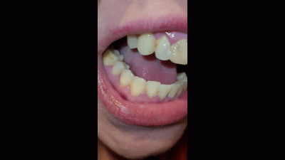 Mouth Tour 1 Week Without Brushing My Teeth A Custom