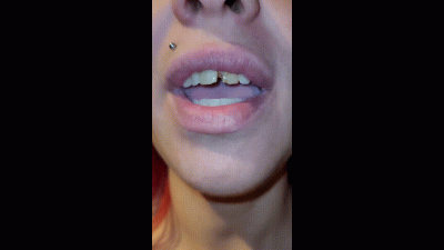 1 Week Without Brushing Your Teeth, Just Smoking, It Rotted And Broke - A Custom