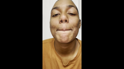 Peach Bite, Then You're Next: Tiny's Tasty Fate