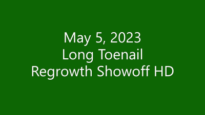 May 5, 2023 Long Toenail Regrowth Showoff HD