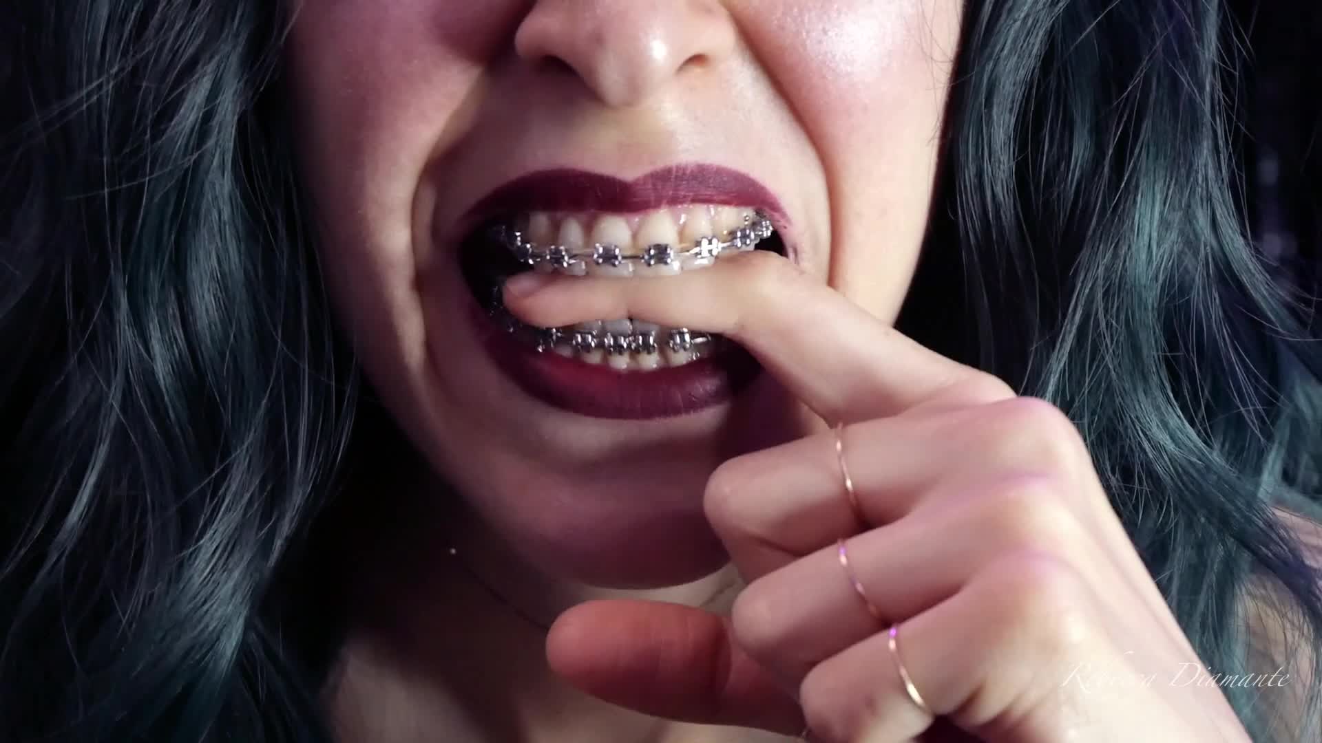 Biting My Own Fingers- Bite, Mouth, Teeth, Braces, Fetish Ita