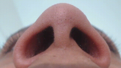 Up Close Nose Flare And Nose Pinch