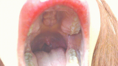 Moving Uvula