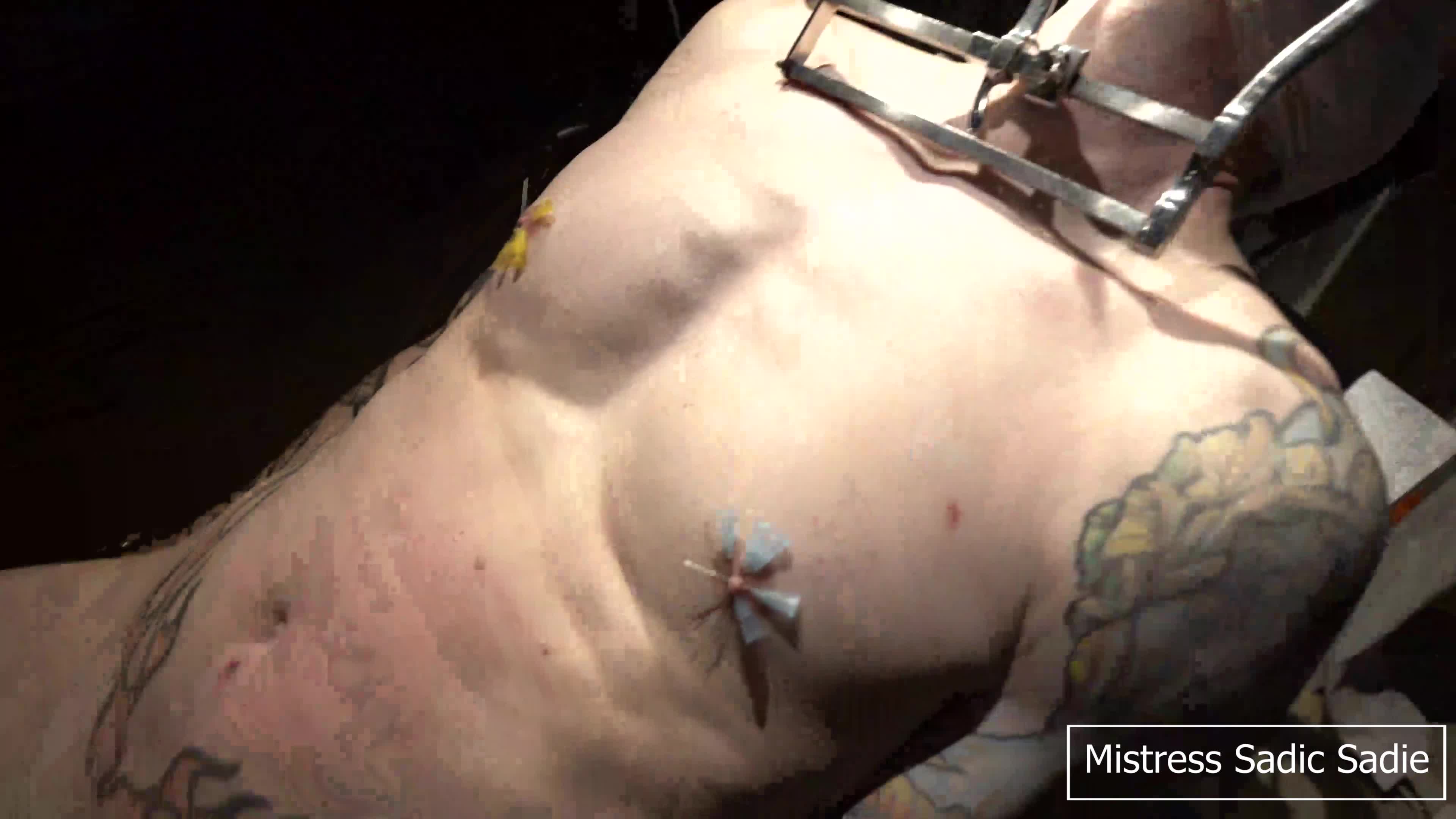 Needle Play, Electro Play While Being Tied Up With A Huge Medical Gag And Bandage Blinfold