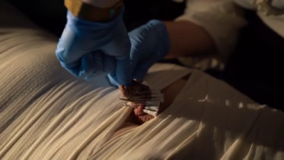 Medfet: Mummification, Electro Play Combined With Needle Play And Some Breath Play Part2