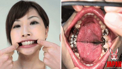 Teeth Inspection Chronicles: Dive Into Yua Hidaka's Enigmatic Oral Realm