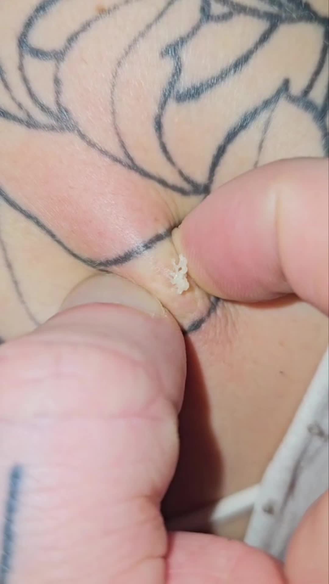 Zit Popping-Squeezing - Porn Video Clips For Sale at iWantClips