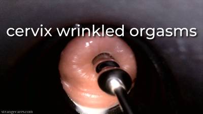 Cervix Wrinkled Orgasms