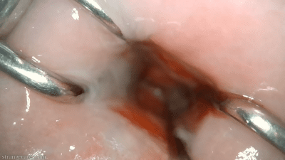Shrinking You To Stuff You In My Cervix
