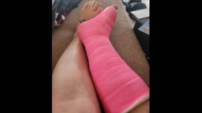 ASMR Fiberglass Cast