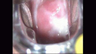 Gyno Role Play, Inside Pussy View