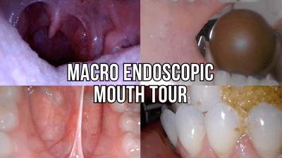 Macro Endoscopic Mouth Tour Lalo Cortez And Vanessa