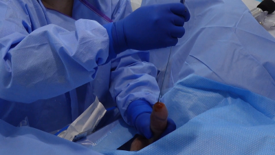 Doctor Performs Surgical Medfet Sounding With Surprise Titty Fuck