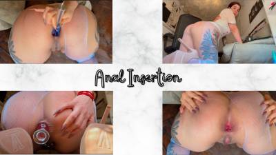 Anal Insertion: Gaped Butthole By Whisk