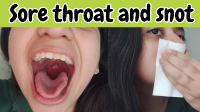 Coughing, Showing My Uvula And Snot Blowing