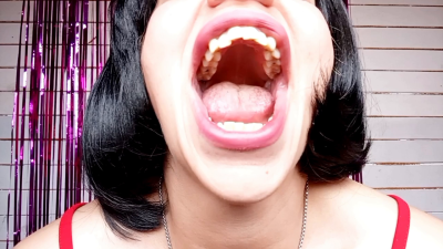 Examination Of The Mouth, Crooked Teeth, Tongue, Decayed Molars, And Throat