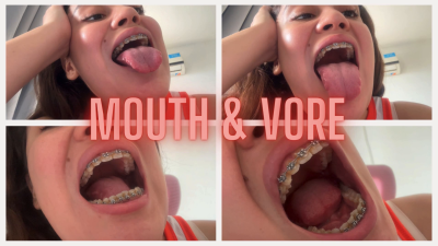 Mouth Fetish And Vore Whit Braces