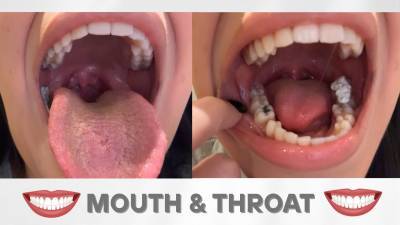 Mouth And Throat Fetish Open Mouth Uvula Movement