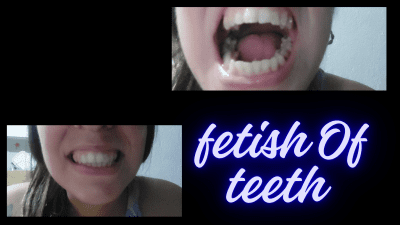 Imperfect Teeth