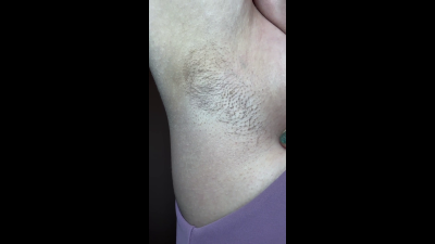 Winter Is Coming Hairy Lady Armpit Worship