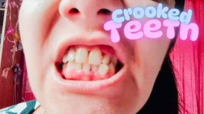 Dirty Crooked Teeth