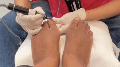 Pedicure 1