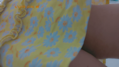 Peek A Boo Up My Sun Dress