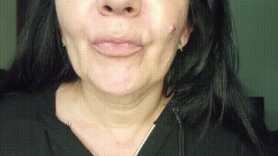 Crooked Teeth Fetish